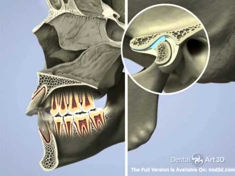 Video thumbnail — how the airway is connected to TMJ and facial pain